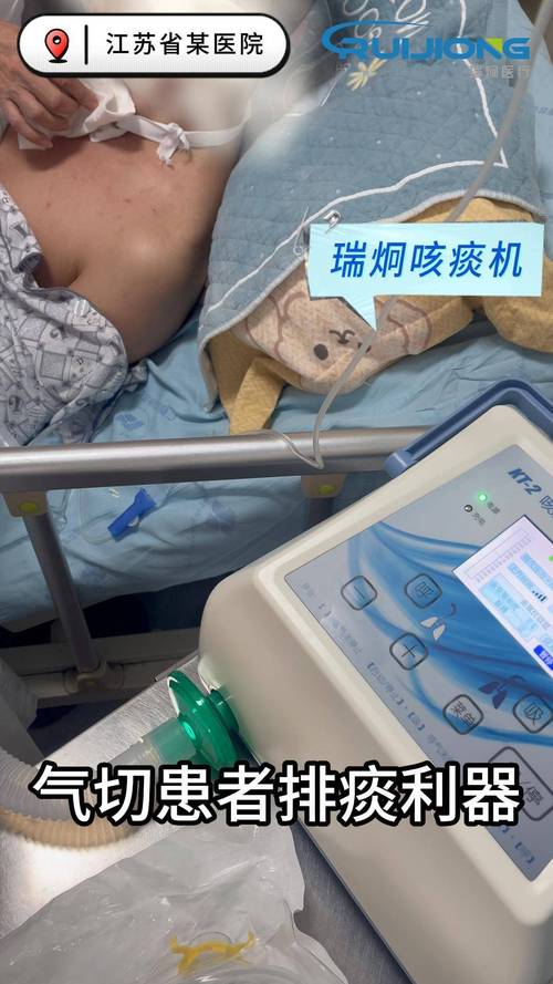 脑梗有痰用切开气管吗