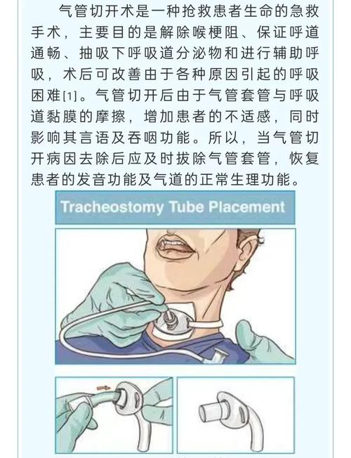 脑梗有痰用切开气管吗