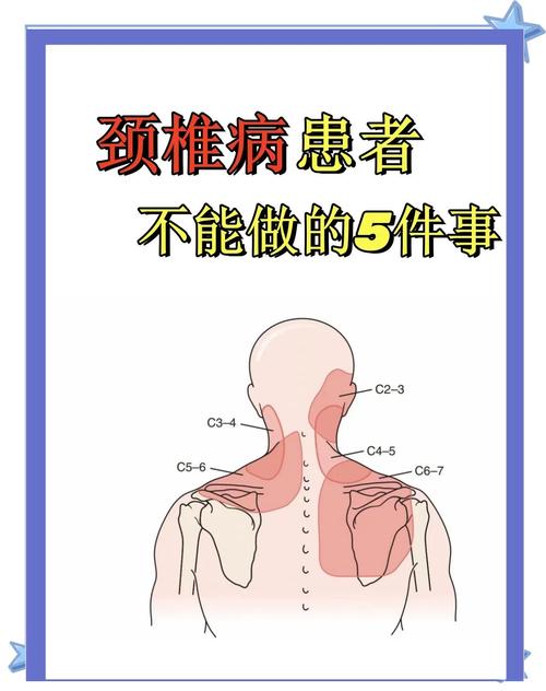 颈椎病跟风湿有关系吗