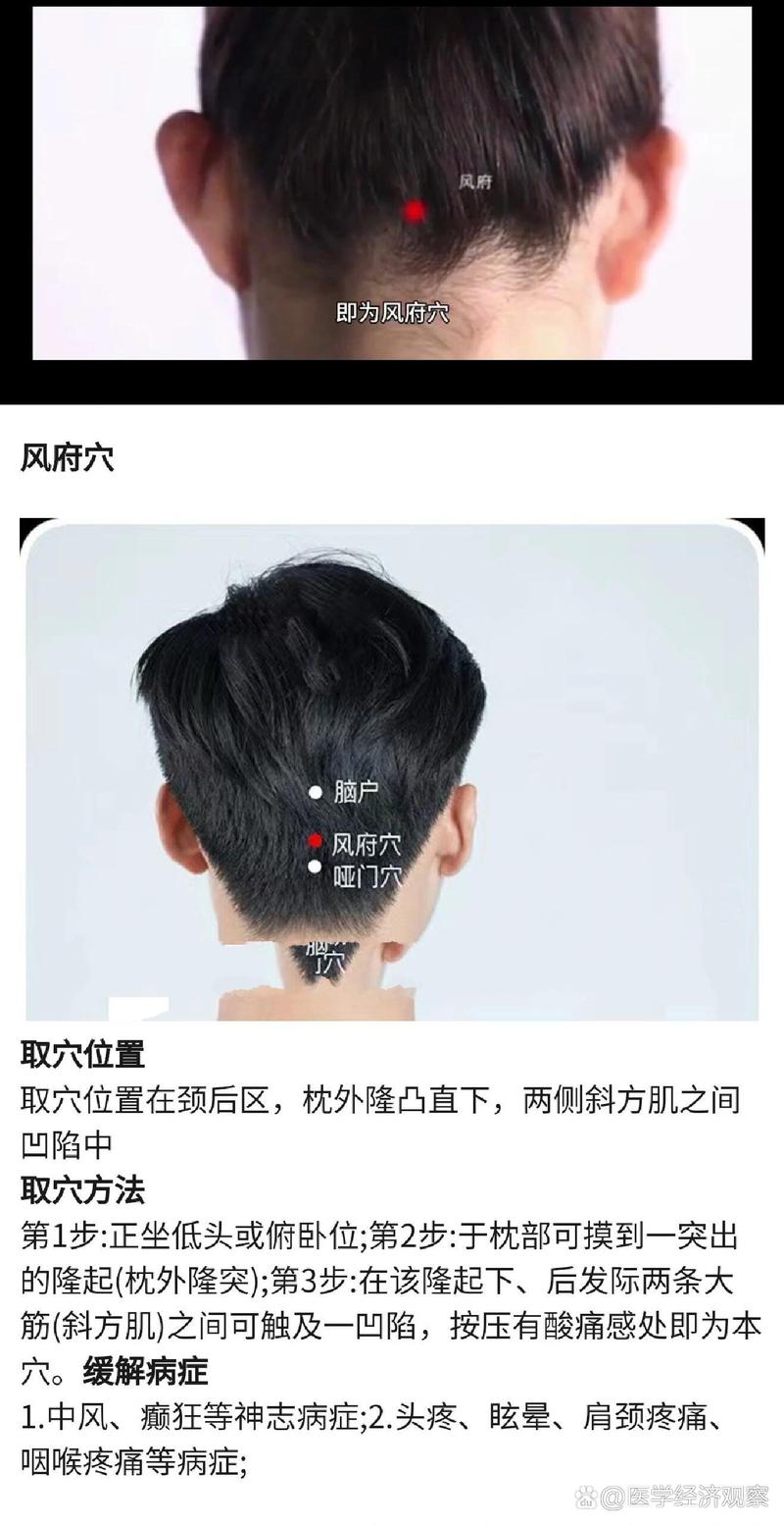 按摩什么穴位会祛风