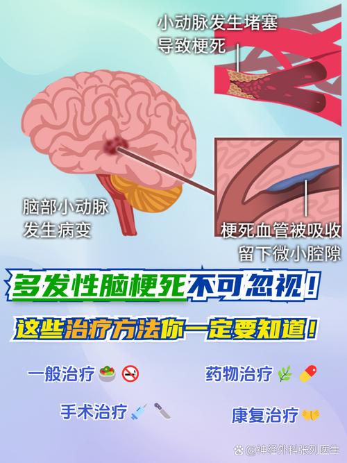 患多发性脑梗怎么死亡