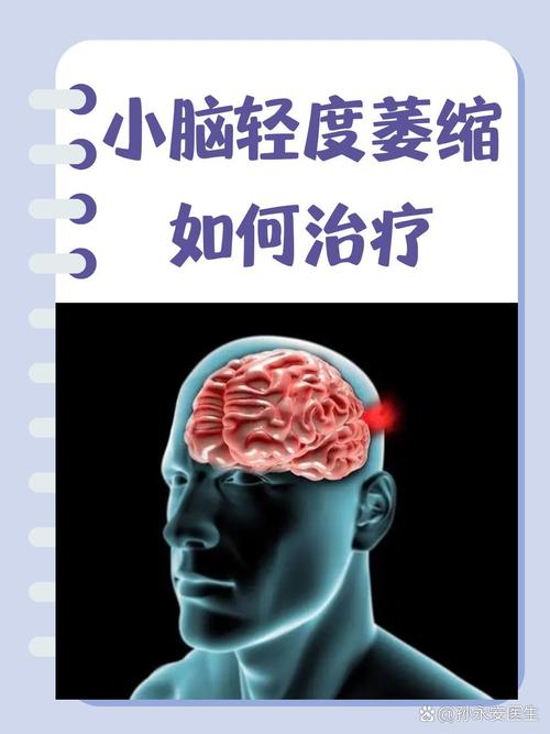 小脑萎缩和脑梗的区别
