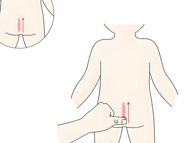 小孩拉肚子穴位推拿