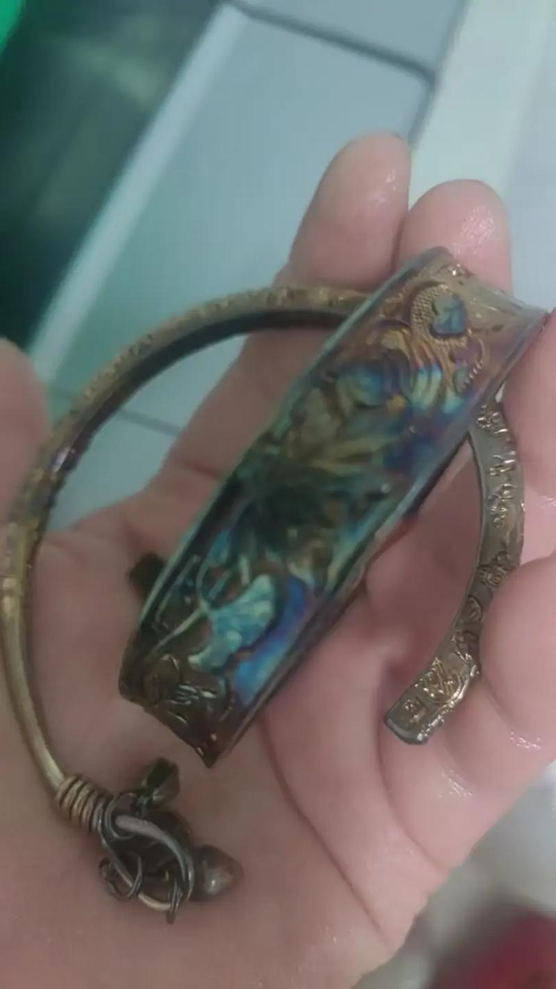 纯银能去风湿关节炎吗