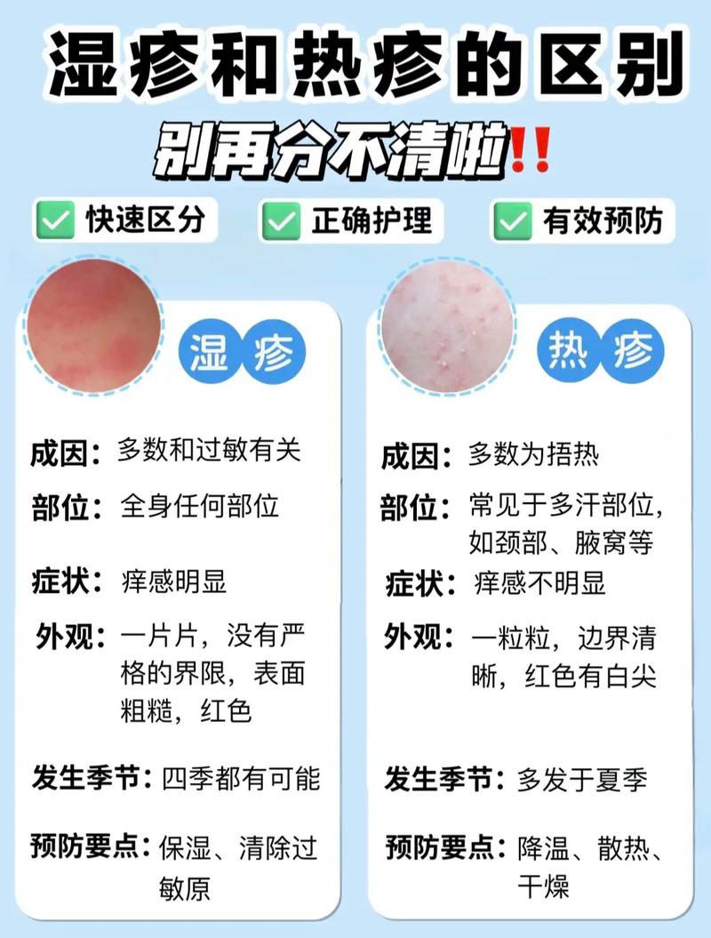 风湿热会遗传给孩子吗