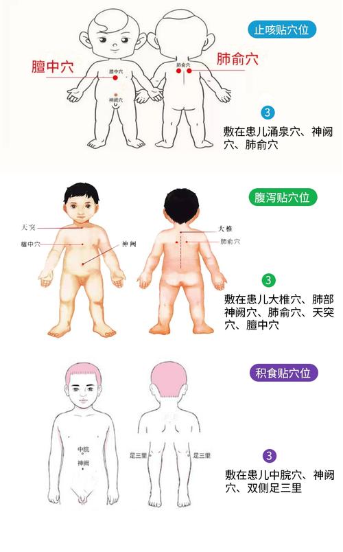 小儿发热穴位敷那些
