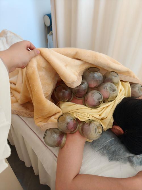 圆利针疗法治产后风湿