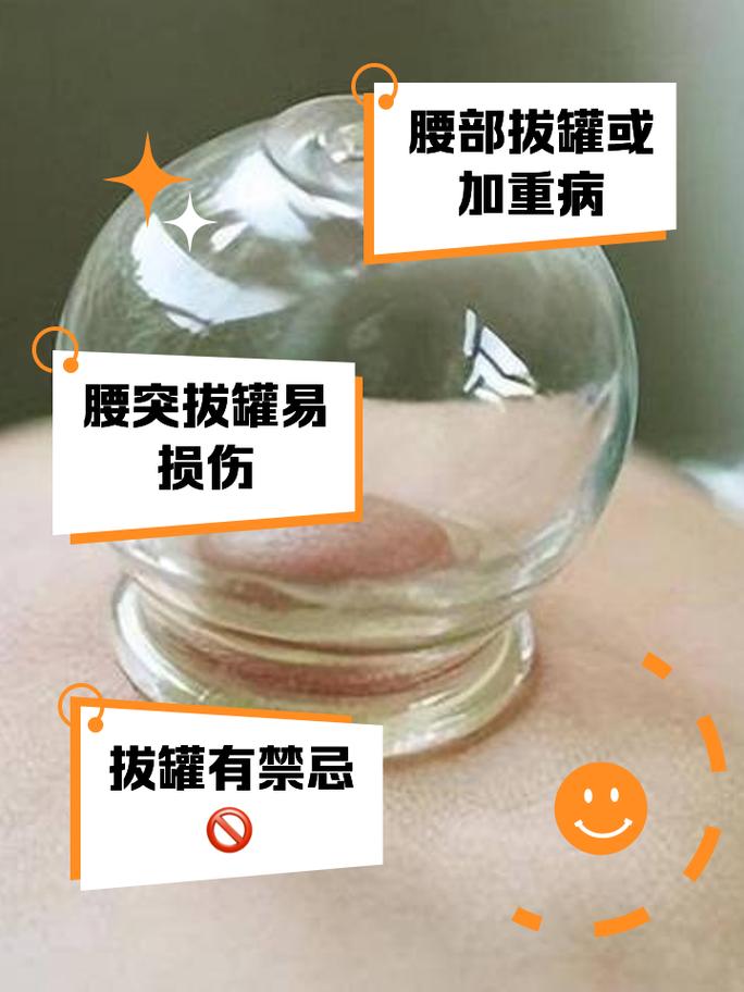 风湿在什么地方拔罐图