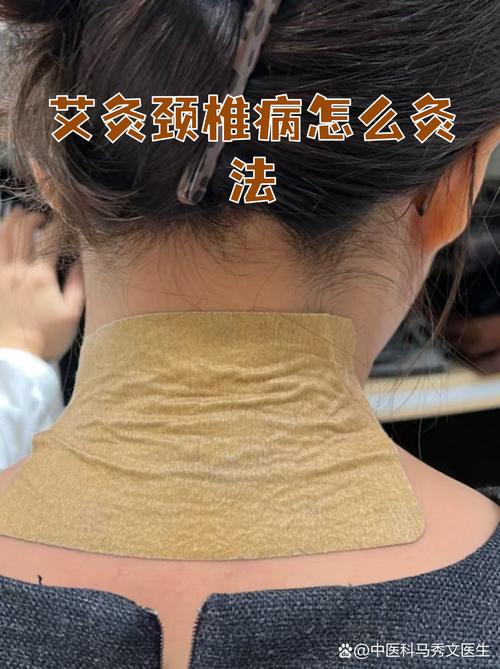 中医穴位外敷治颈椎