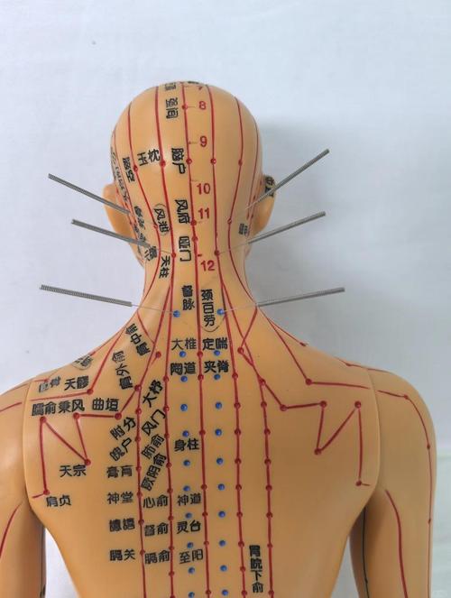 颈部的针灸穴位注意