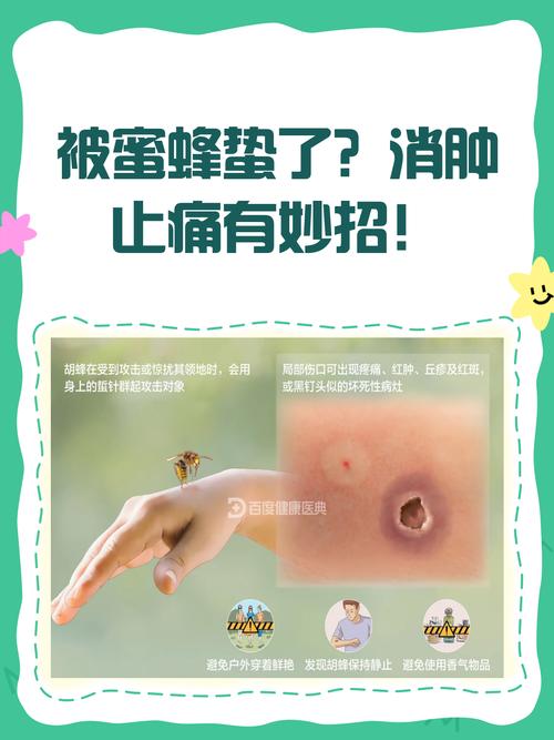 蜜蜂蛰能治风湿关节炎