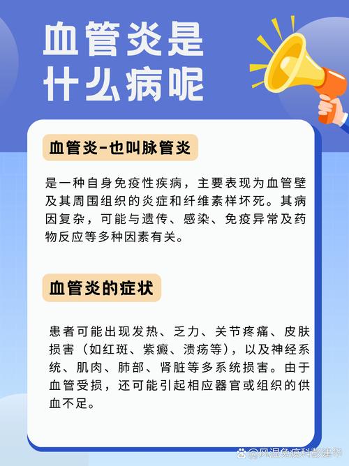 类风湿血管炎看什么科