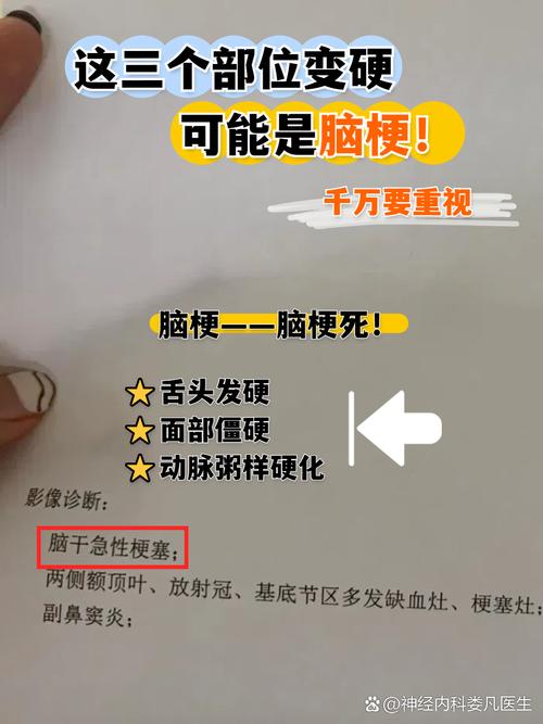 脑梗说话不清楚老是哭