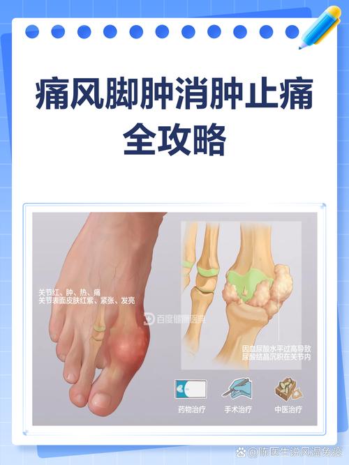 类风湿肿的厉害怎么办