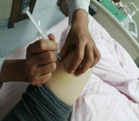 三磷酸腺苷穴位注射