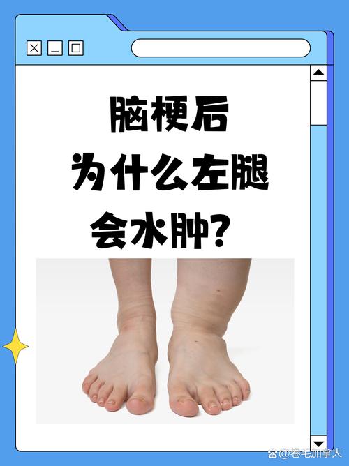 脑梗左腿不能动怎么办