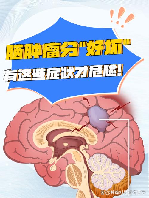 脑瘤和脑梗瘤有区别吗