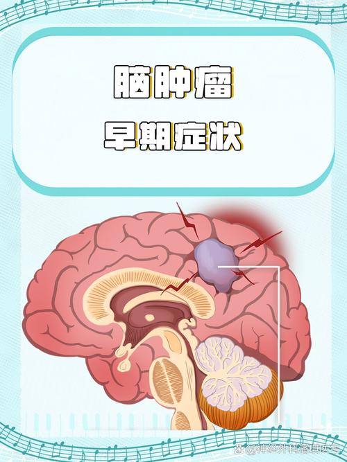 脑瘤和脑梗瘤有区别吗