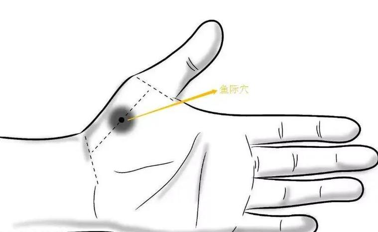 手痛风针灸哪个穴位