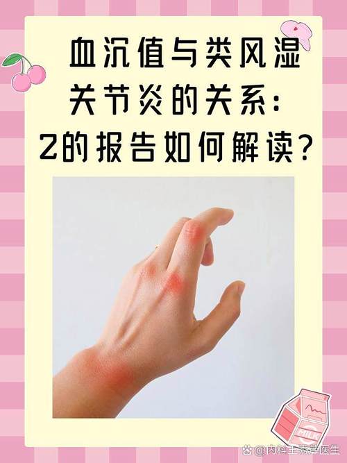 类风湿关节炎辅助检查