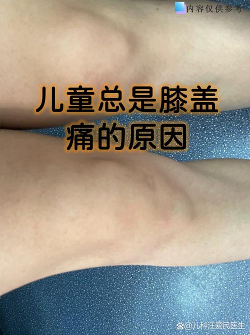 小孩风湿关节炎好治吗