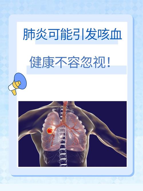 风湿性心脏病咳血治疗