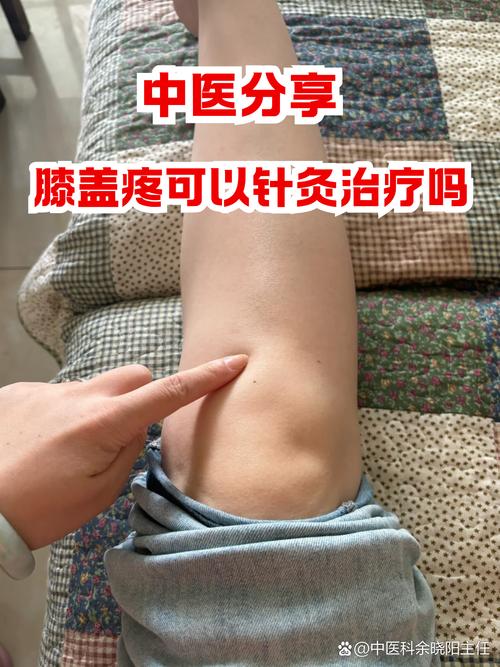 类风湿腿肿胀中医疗法