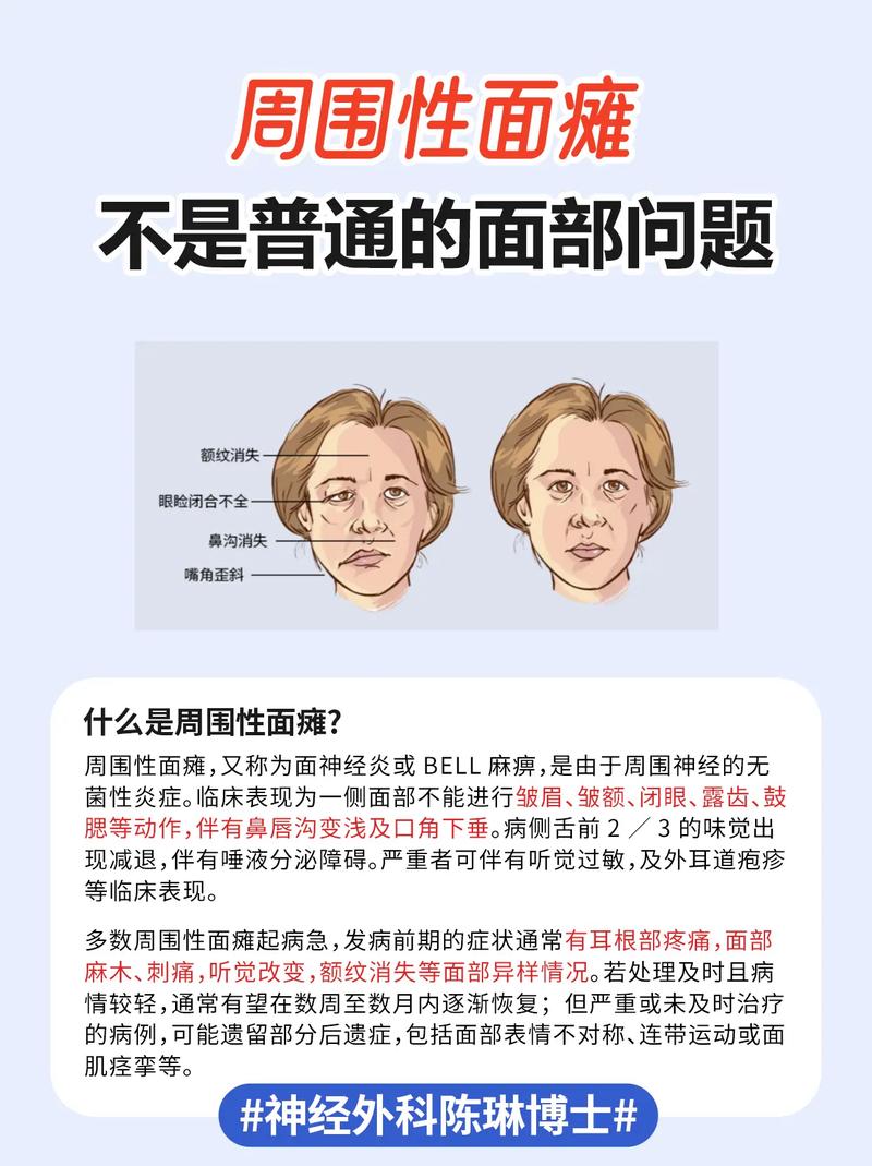 脑梗引起的面瘫能好吗