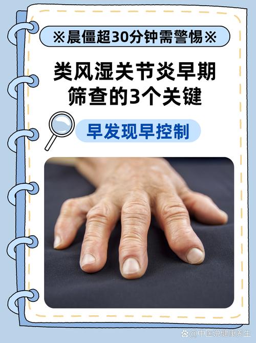 早期类风湿能控制住不