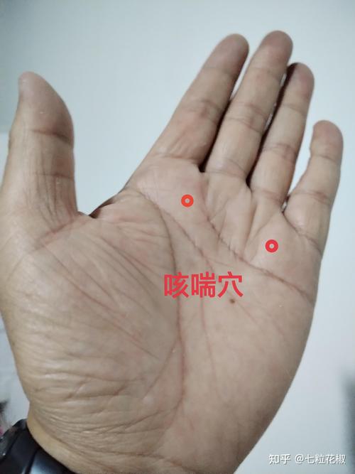 小儿咳嗽针灸穴位图