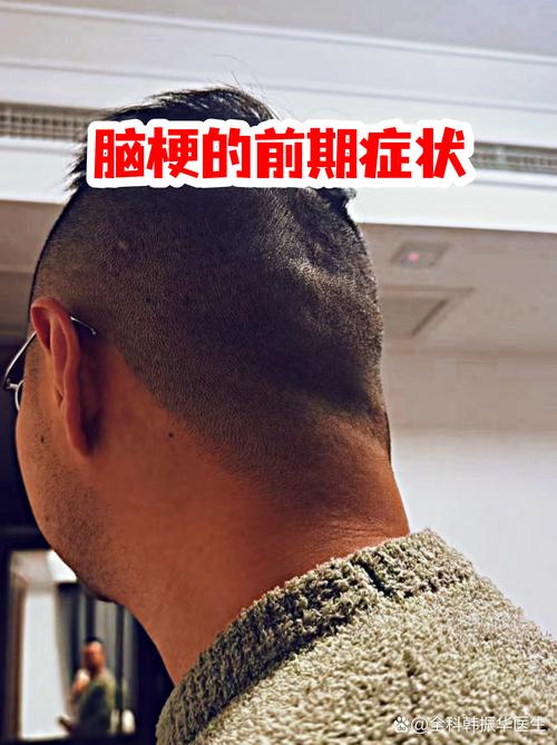 脑梗急性发作期的症状