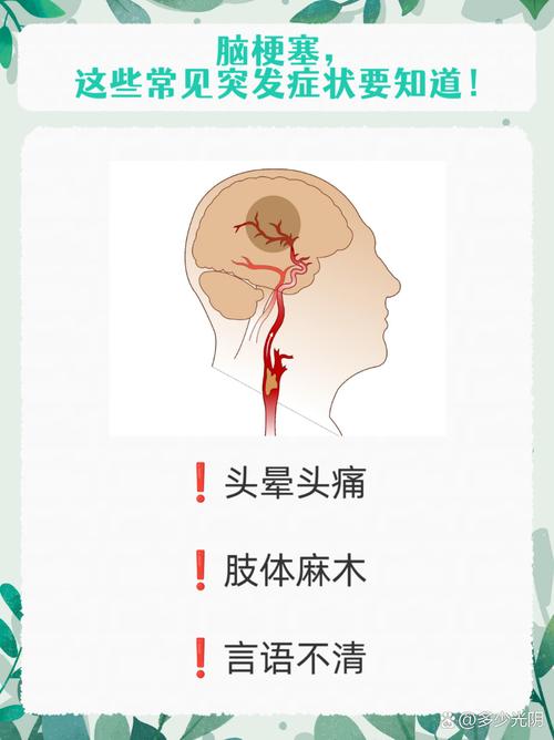 脑梗急性发作期的症状