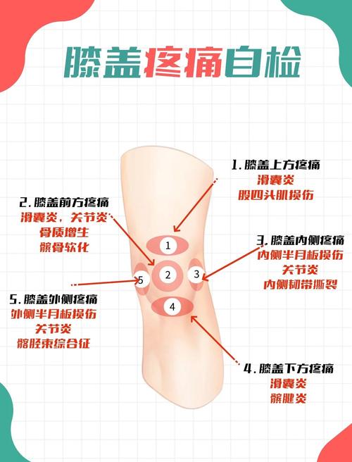 风湿膝关节疼怎么治疗