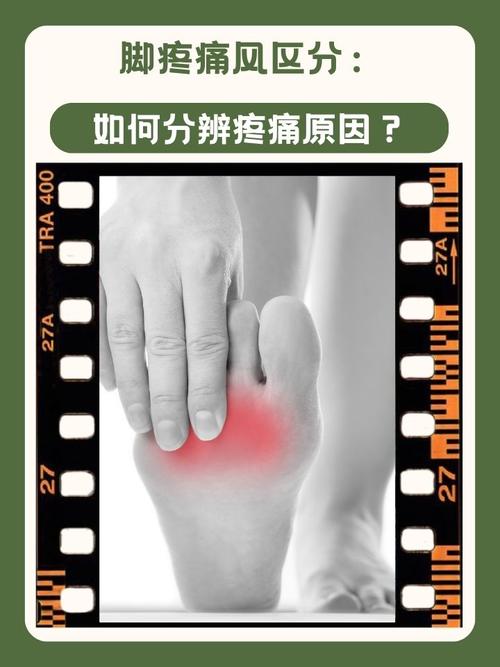 缺钙痛和风湿痛的区别