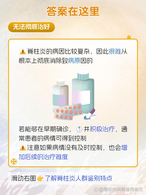 类风湿脊柱炎怎么治疗