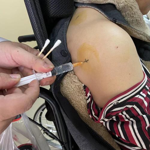 穴位注射有哪些危害