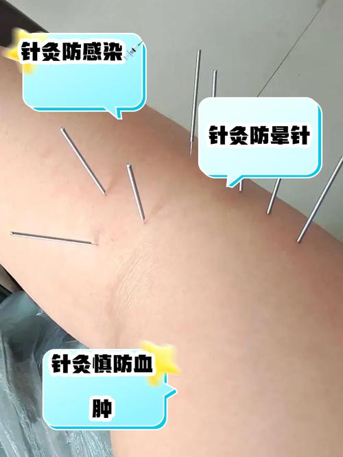 年轻人可以打风湿针吗