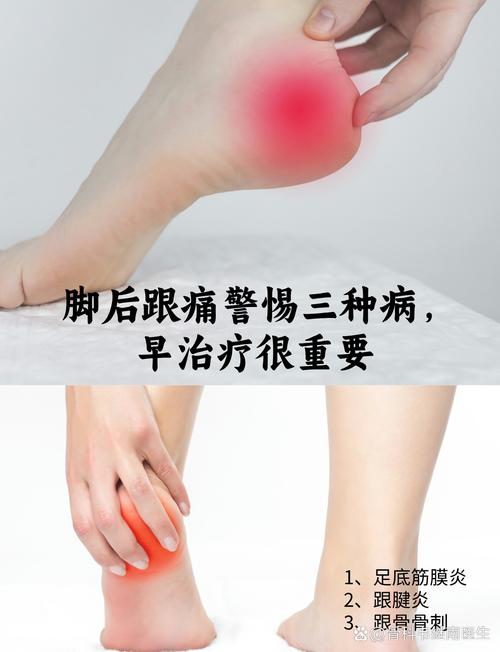 脚疼和类风湿有关系吗