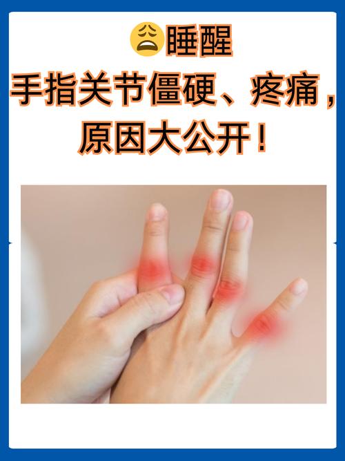 风湿病手痛是什么症状