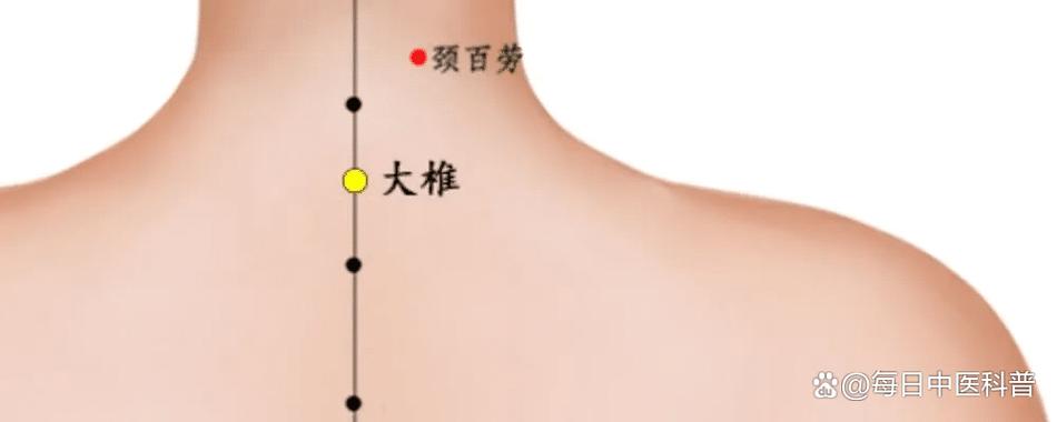 颈部大椎穴位置图片