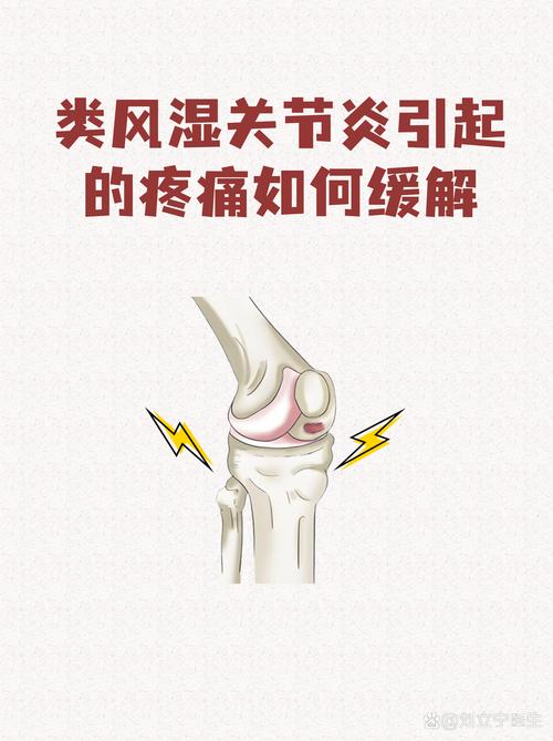 缓解类风湿关节炎疼痛