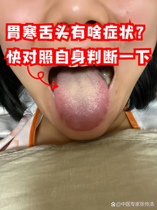 胃风湿病的症状是什么
