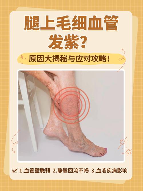 血管炎跟风湿有关系吗