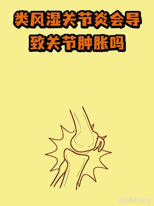 生完宝宝能得类风湿吗