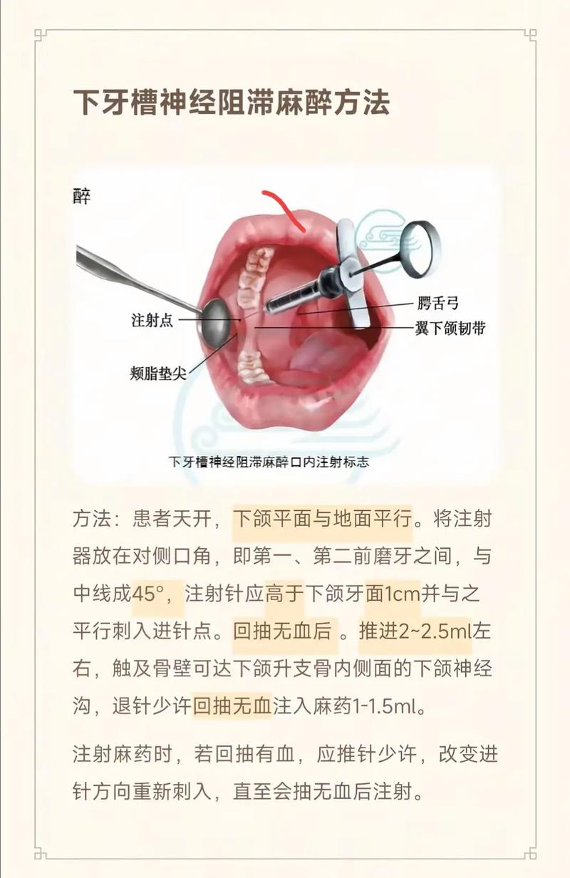 脑梗可以打麻药拔牙吗