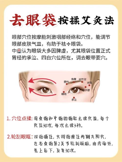 针灸什么穴位去眼袋