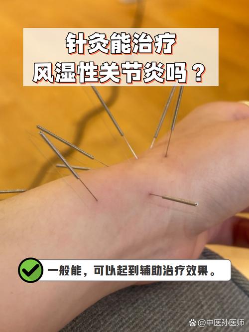 风湿关节炎针灸管用吗