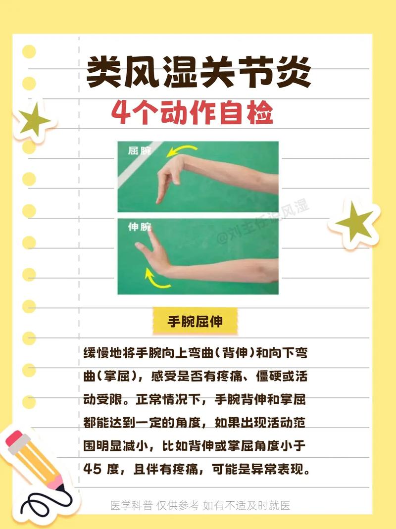 风湿多肌痛的治疗方法