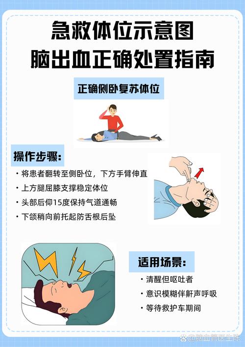 脑梗 口出血怎么回事