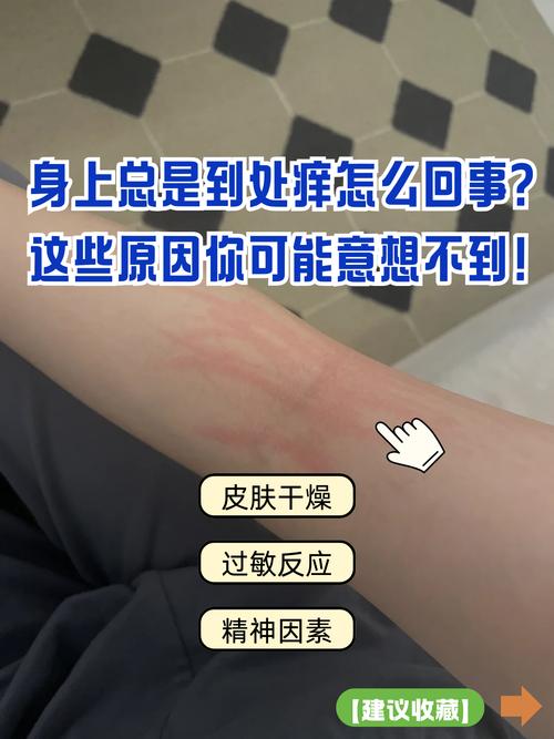 脑梗患者为什么身上痒